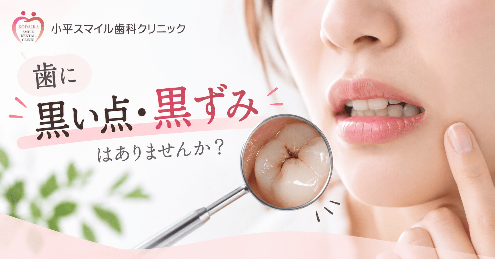 歯に黒い点・黒ずみがあるのは虫歯?考えられる原因を解説